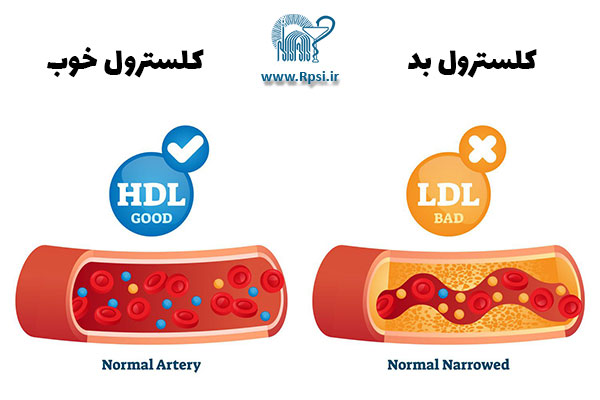کلسترول بالا