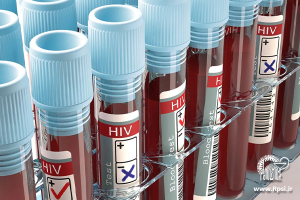 ایدز و HIV