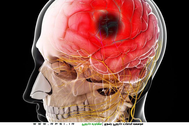 اثرات کرونا بر بدن -مشکلات مرتبط با مغز