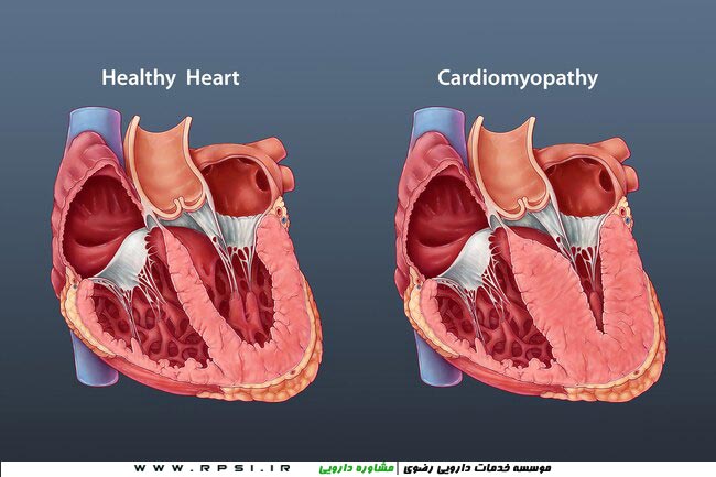 اثرات کرونا بر بدن - مشکلات قلبی