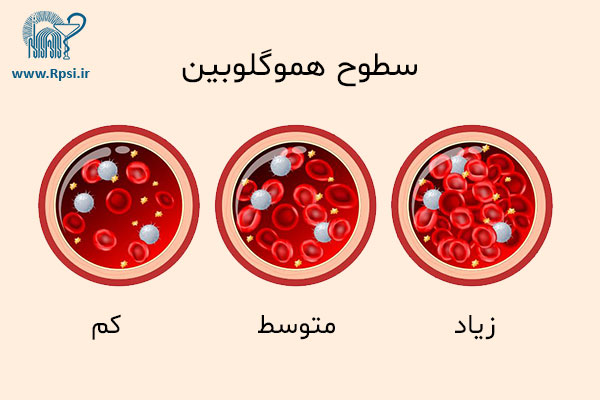 هموگلوبین