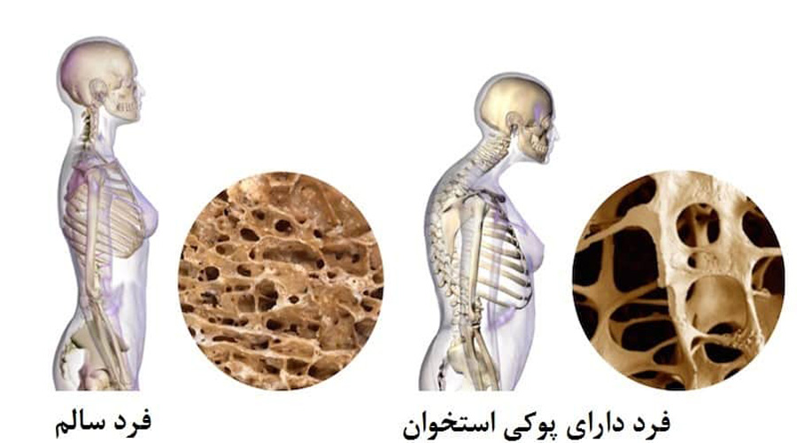 پروتئین