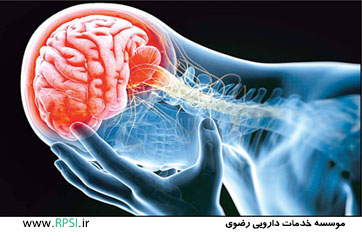 سکته مغزی ، علل علائم و درمان