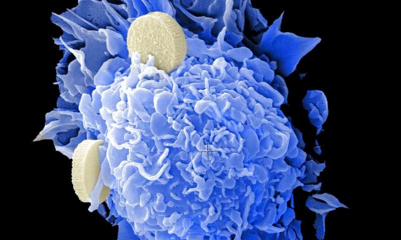 New findings on obesity and response to cancer therapy