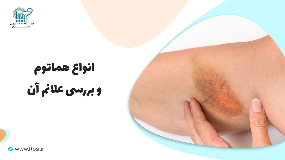 هماتوم چیست و چه علائمی دارد؟