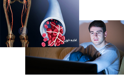 Too Much TV Could Boost Your Odds for a Blood Clot