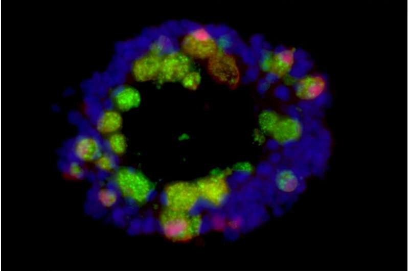 Western diet may increase risk of gut inflammation, infection