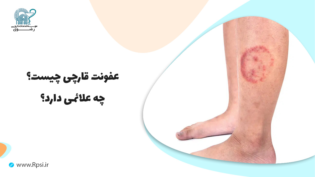 عفونت قارچی چیست و چه علائمی دارد؟