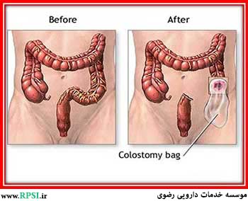 مقالات مشکلات گوارشی
