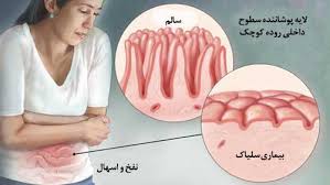 مقالات مشکلات گوارشی