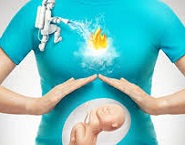 Heartburn During Pregnancy