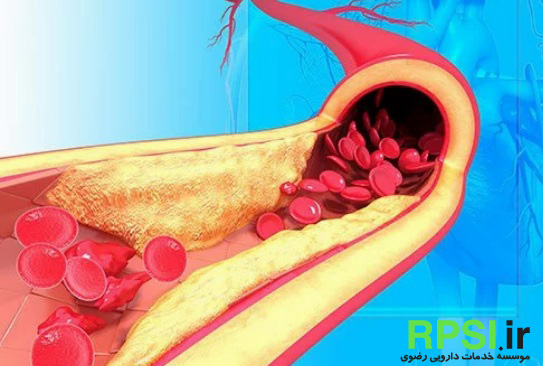 فشارخون بالا چه مشکلاتی می تواند ایجاد کند ؟