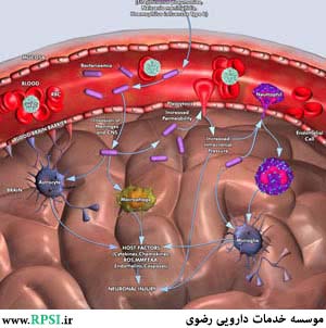 مننژیت حاد باکتریایی در بزرگسالان