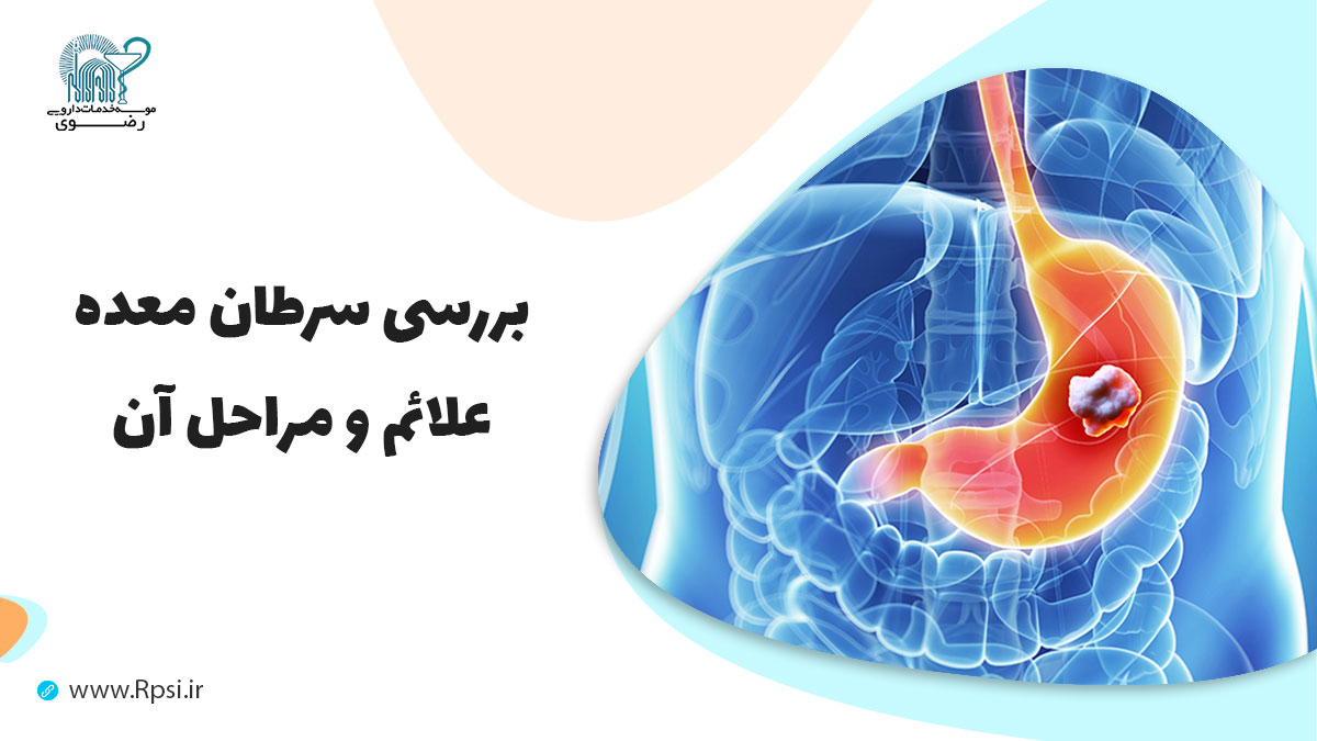 سرطان معده (آدنوکارسینوم معده) چیست؟