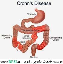 مقالات مشکلات گوارشی