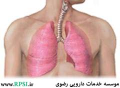 سرطان ریه