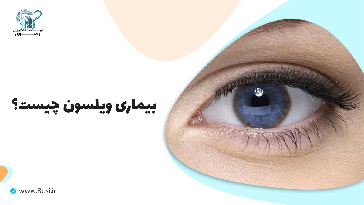 بیماری های مغز  و  اعصاب