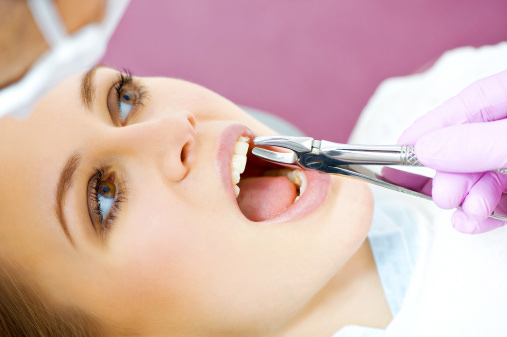 کشیدن دندان و توصیه های مرتبط