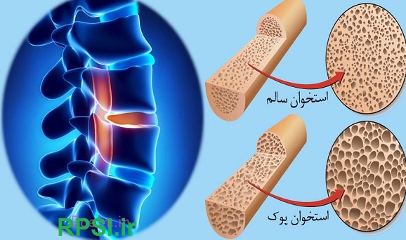 توصیه‌هایی برای انجام آزمایش تراکم‌سنجی استخوان