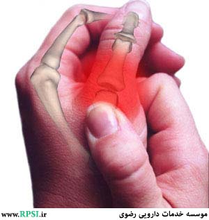 What is rheumatism and how can it be cured? 