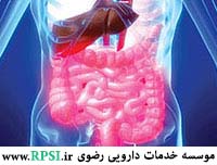 سندروم روده تحریک پذیر چیست؟