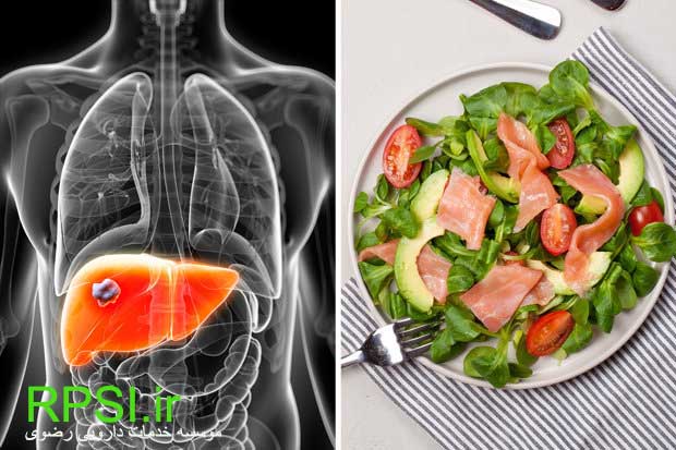 How to Eat Right With Fatty Liver Disease