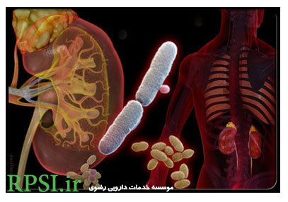 عفونت مجاری ادرار ؛ علل علائم پیشگیری و درمان